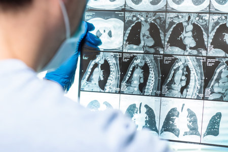 Doctor attentively examines the MRI scan of the patient