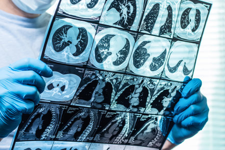 Doctor attentively examines the MRI scan of the patientの写真素材