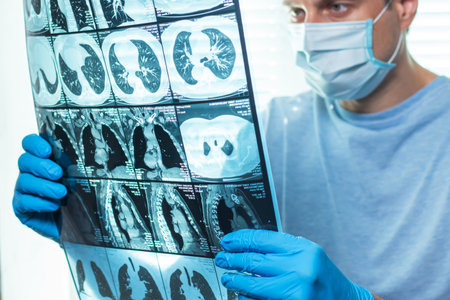 Doctor attentively examines the MRI scan of the patient