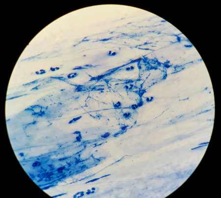 Smear of Acid-Fast bacilli AFB stained from sputum specimen, under 100X light microscope.