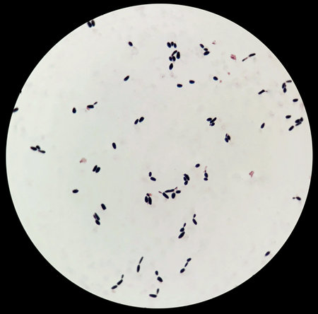 Smear of positive budding yeast from hemoculture gram stained, under 100X light microscope.