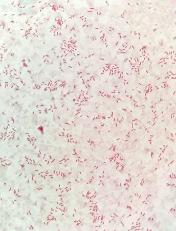 Smear of human blood cultured Gram' s stain with gram negative bacilli bacteria.の素材