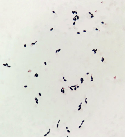 Smear of human blood cultured Gram' s stain with budding yeast cell.