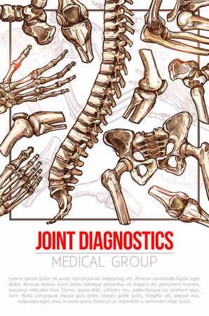 Medical vector poster for joint diagnosticsのイラスト素材