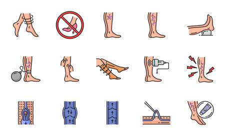 Varicose treatment icons, leg veins disease and thrombosis surgery, vector line symbols. Varicose or vascular varices circulation insufficiency, medical treatment, compression therapy and prophylacticのイラスト素材