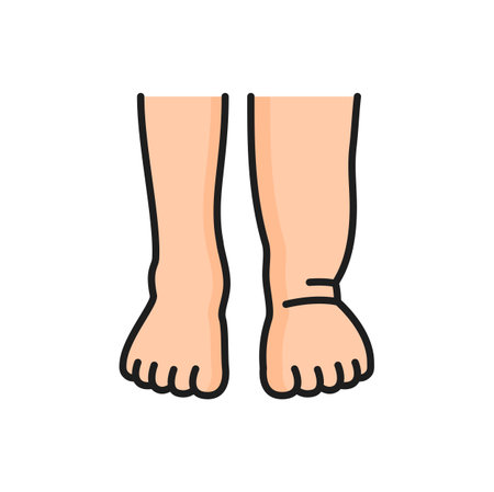 Foot disease and trauma injury of foot, allergic reaction color line icon. Vector lymphedema, swelling legs and edema allergic reactionのイラスト素材