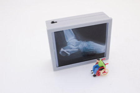 A detailed medical x-ray monitor with a model figure in a wheelchair,の写真素材