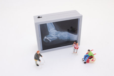 small figurines interacting with a medical X-ray display, depicting the themesの写真素材