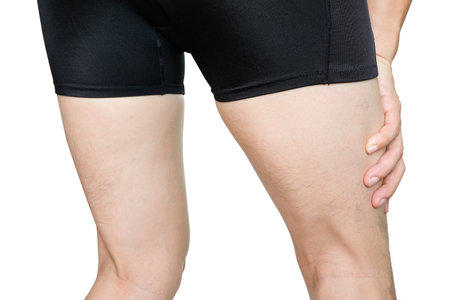 Leg muscle pain.young man  and grasped his muscles. With foot pain and stretching, fatigue muscles...