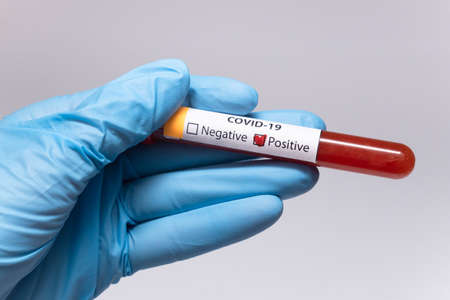 Blood positive test to coronavirus. Medical reseach, test-tube with blood, hand in latex medical...