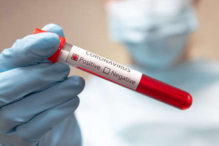 Coronavirus positive blood test. Doctor in protective suit, medical mask and latex gloves holds a test tube with blood.の写真素材
