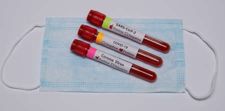 Blood positive test to coronavirus. Medical reseach, test-tubes with blood, medical mask. Coronavirus outbreak and influenza. 2019-nCoV, covid-19, sars. High quality photoの写真素材