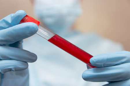 Coronavirus blood test. Doctor in protective suit, medical mask and latex gloves holds a test tube...