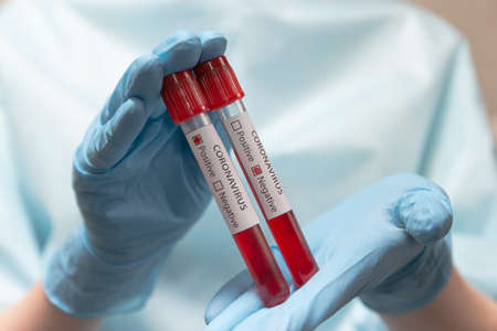 Coronavirus positive and negative blood test. Doctor in protective suit, medical mask and latex gloves holds a test tubes with blood.の写真素材