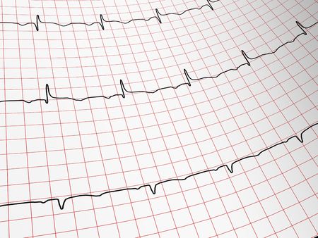 EKG -  Monitorの写真素材