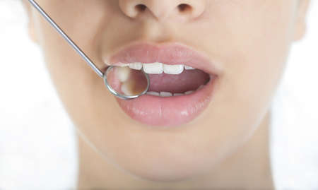 Beautiful smile with dental mirrorの写真素材