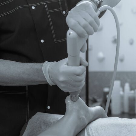 Acoustic shock waves physical therapy for foot, closeup photo
