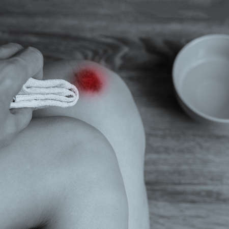 Bw photo of sick woman cleaning her wound on knee
