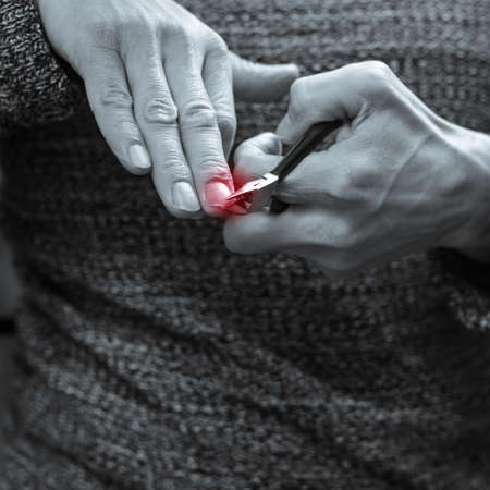 Monochrome photo of injured male finger after home manicure