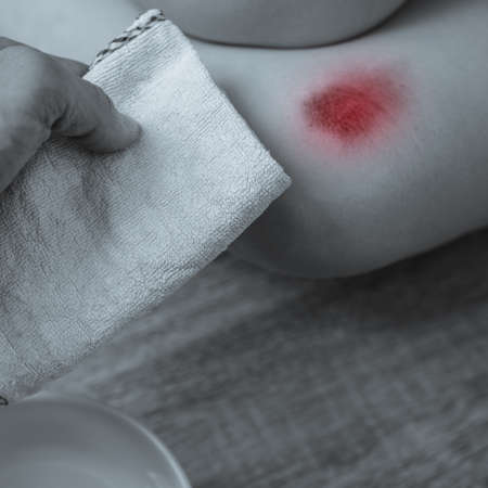 Woman using cotton napkin to relieve pain on injured legの写真素材