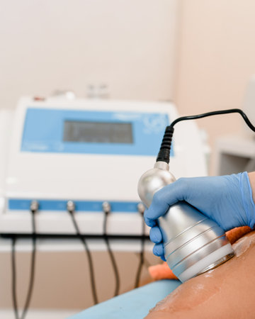 Closeup of woman receiving laser epilation treatment in beauty salonの写真素材