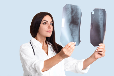 Shocked brunette female radiologist compares two X rays, shocked with bad consequences, realizes patient has serious problems with spine, wears white medical robe, isolated over studio wall.の写真素材