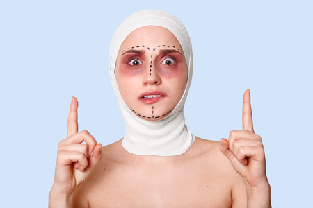 Closeup of female facial expressing . Surprised, scered and shocked lady waits for medical procedure. Woman in bandage on head bites lip and points forefingers up. Plastic surgery concept .の写真素材
