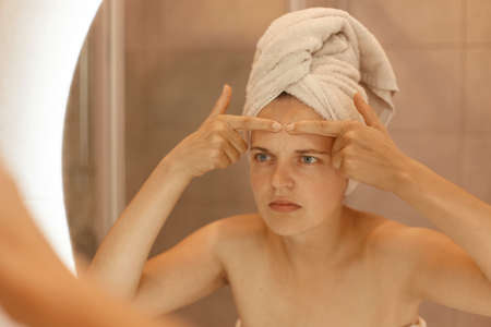 Closeup portrait of young woman with acne on her forehead, looking at the bathroom mirror with worried expression, posing with naked shoulders, beauty procedures.の写真素材