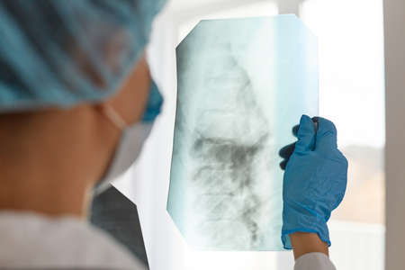 Closeup back side shot of woman doctor in medical cap and blue gloves, radilogist holding x-ray, holding radiology picture, thinking about illness and its trreatment, health care.の写真素材