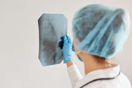 Back view of female doctor looking at an x-ray picture, wearing medical disposable cap and gloves,...