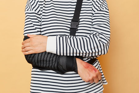 Domestic painful accidents and people. Unrecognizable woman fell down from stairs at home, has injuries, broken arm, cures at rehabilitation center posing isolated over beige backgroundの写真素材