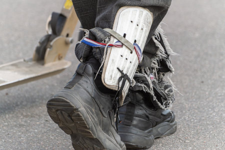 Close-up of poor man's feet