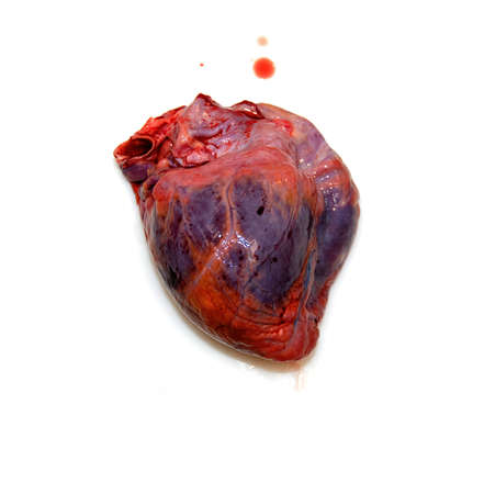 An isolated heart on a white background with symptoms of cardiac suffering next to a drop of bloodの写真素材