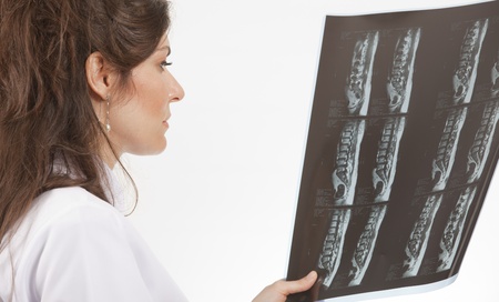 	female doctor looking at x-ray film