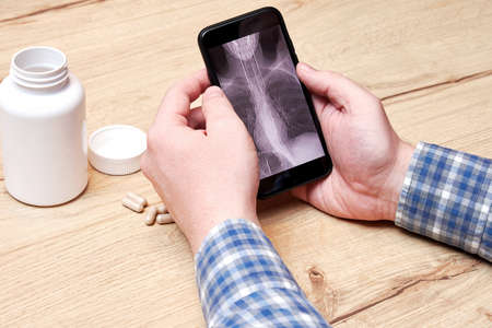 Man analyzing digital CT scan of his lungs at home. Pneumonia and disease diagnosis. Pills and medical bottlesの写真素材