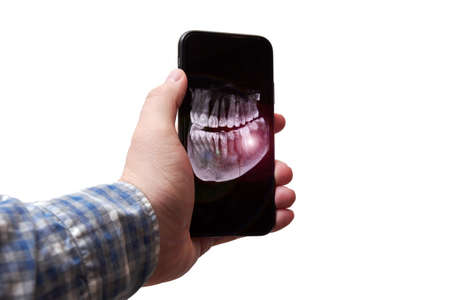 Mans hand holding a mobile phone with an x-ray image of his jaw and tooth. Pain flare highlight....