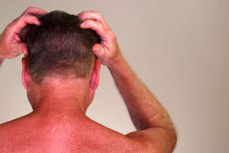 Close-up rear view of a shirtless adult caucasian man massaging with his hands his head that has brown hair. Upper body rear view of a mature white male massaging his scalp with his hands and fingersの写真素材