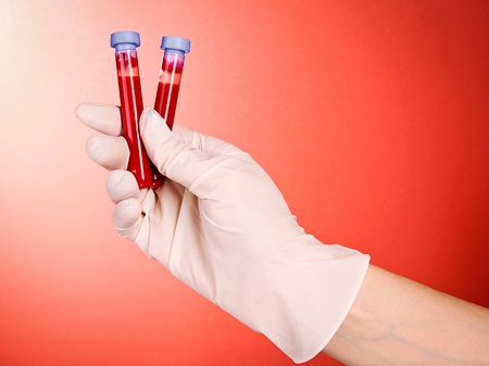 Doctor's hand in glove with blood test tubes on red background