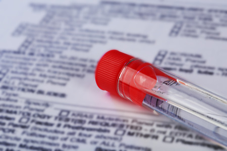 Test tube with medical history form close upの写真素材