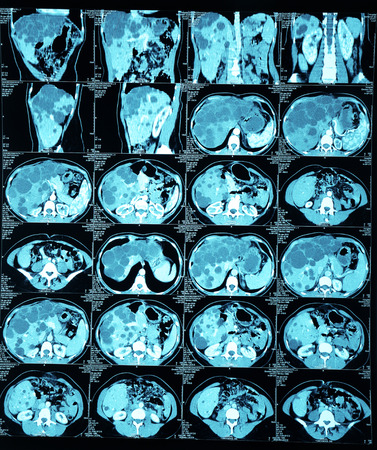 X-ray scanner of internal organs isolated on whiteの写真素材