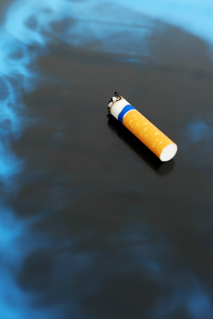 Cigarette on x-ray lung, close upの写真素材