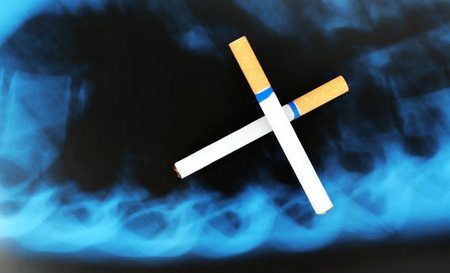 Cigarettes on x-ray lung, close up