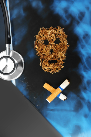 Cigarettes and stethoscope on x-ray lung, close upの写真素材