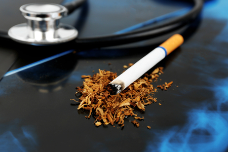 Cigarette and stethoscope on x-ray lung, close upの写真素材