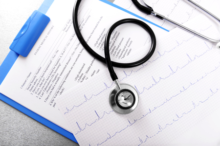 Cardiogram chart with medical stethoscope on table closeupの写真素材
