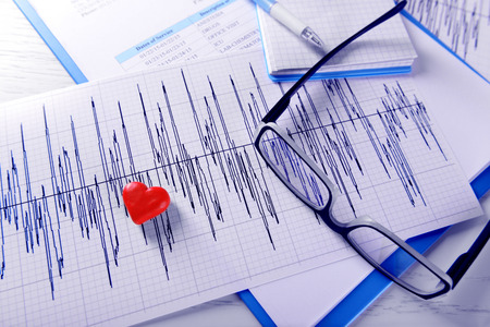 Cardiogram chart with glasses and small red heart on table closeup