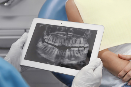 Male hands holding tablet computer with X-ray image of teethの写真素材