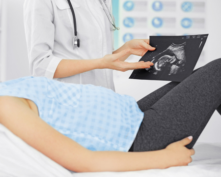 Doctor showing baby ultrasound image to pregnant womanの写真素材