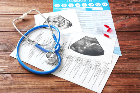 Ultrasound scan of baby with stethoscope and laboratory test on wooden backgroundの写真素材