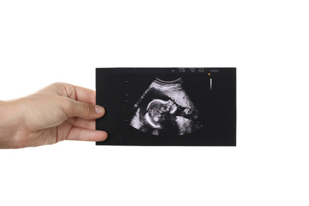 Female hand with ultrasound picture of baby on white background